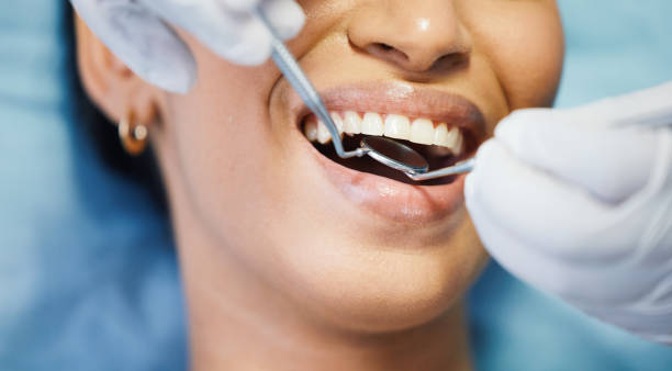 Best Emergency Gum Treatment in Sarcoxie, MO