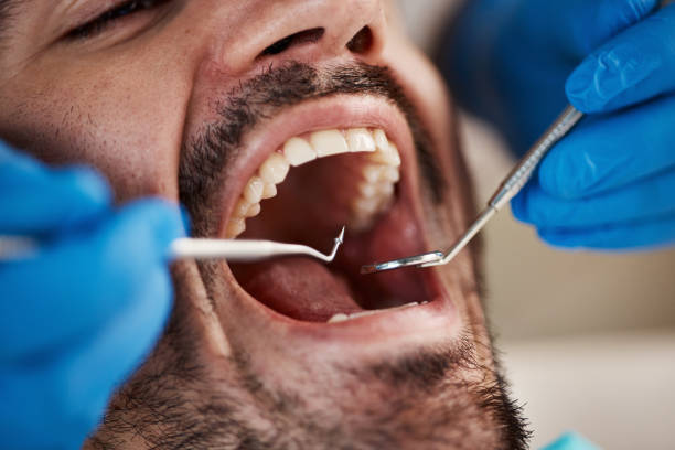 Best Emergency Denture Repair in Sarcoxie, MO